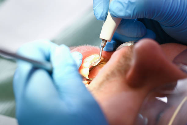 Best Holiday Emergency Dentist in Goliad, TX